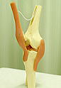 膝の模型いじりすぎて外側側副靱帯損傷！